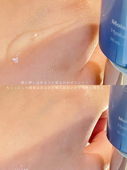 RTXセラム ヒアルショット/Dr.G/美容液を使ったクチコミ(4枚目)