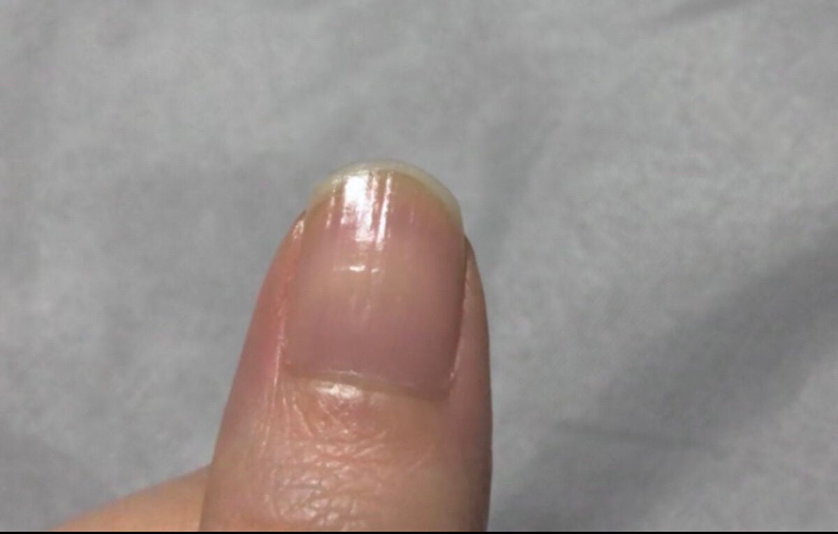 エテュセ クイックケアコート/ettusais/ネイルオイル・トリートメントを使ったクチコミ(3枚目)