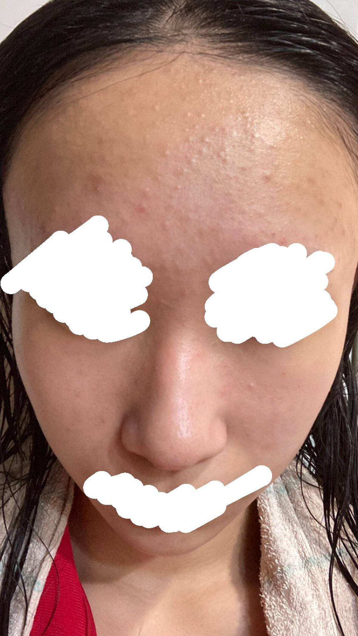 ロゼット洗顔パスタ アクネクリア/ロゼット/洗顔フォームを使ったクチコミ(2枚目)