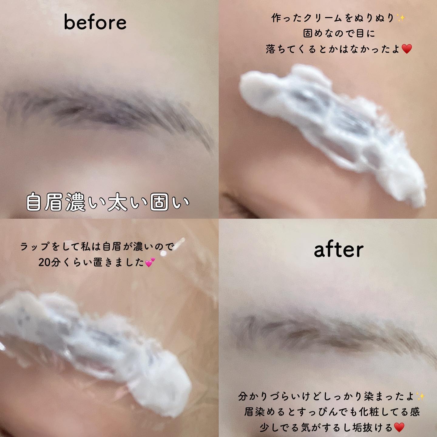 ジョレン クリーム ブリーチ/ジョレンジャパン/ムダ毛ケアを使ったクチコミ（3枚目）