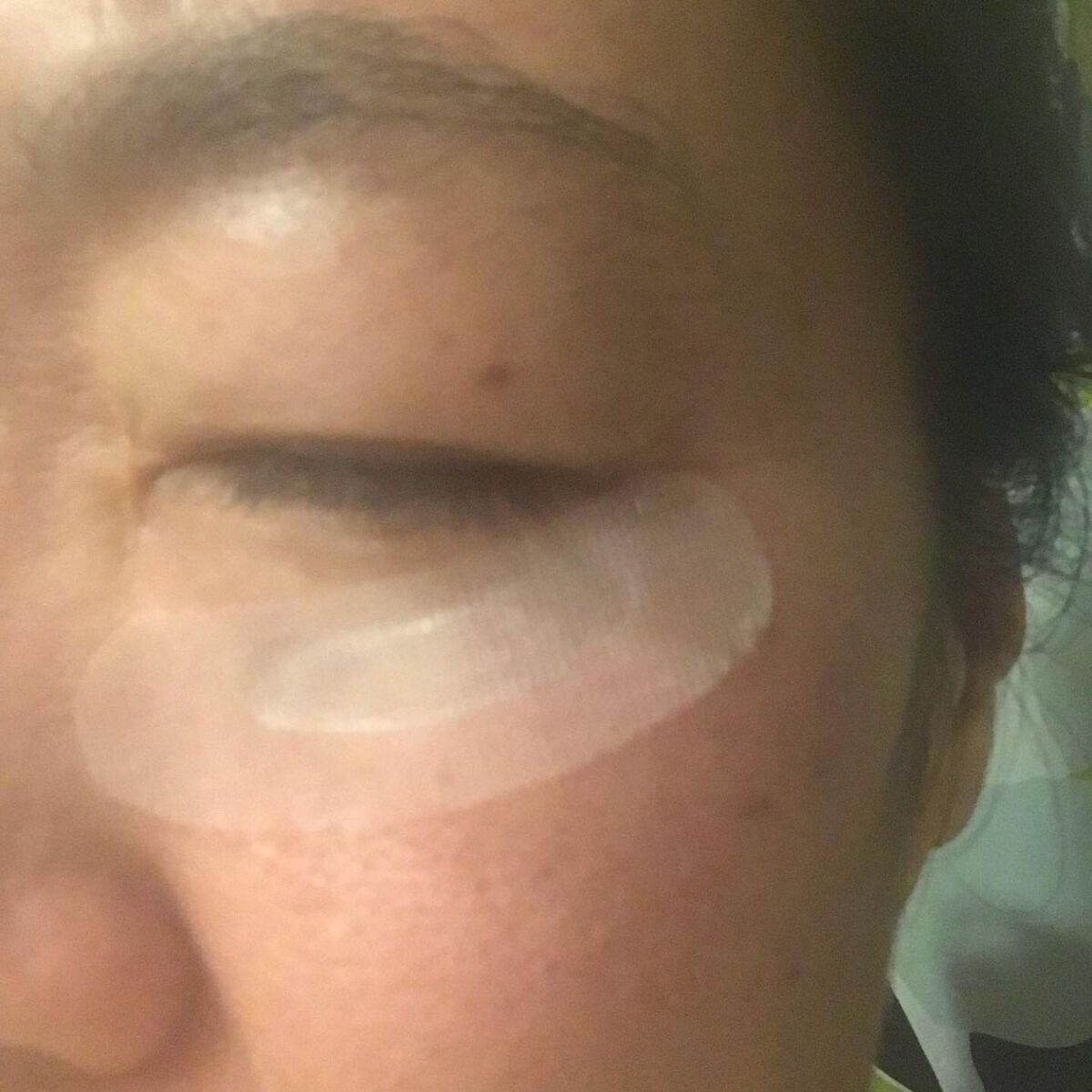 クリアターン ヒアロチューン マイクロパッチ 1500/クリアターン/シートマスク・パックを使ったクチコミ(2枚目)