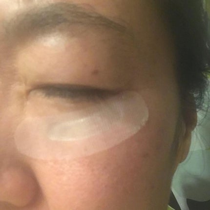 クリアターン ヒアロチューン マイクロパッチ 1500/クリアターン/シートマスク・パックを使ったクチコミ(2枚目)