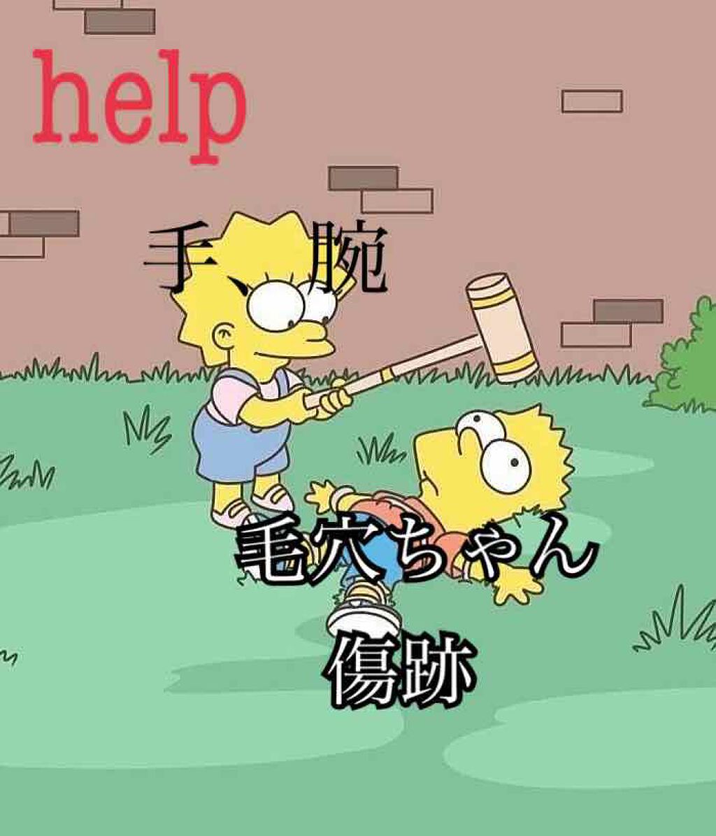 お亀ちゃん on LIPS 「手の毛穴と腕の毛穴と傷跡が泣きそうなくらい酷いです。ニベアとベ..」(1枚目)