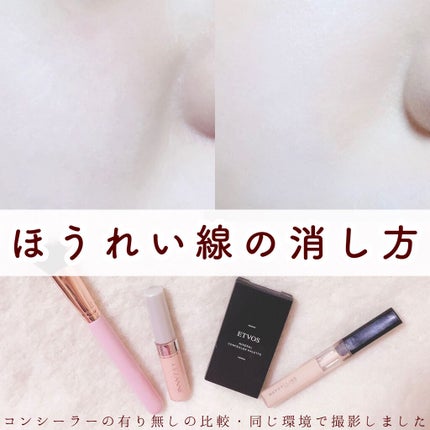 ミネラルコンシーラーパレット/エトヴォス/パレットコンシーラーを使ったクチコミ(1枚目)