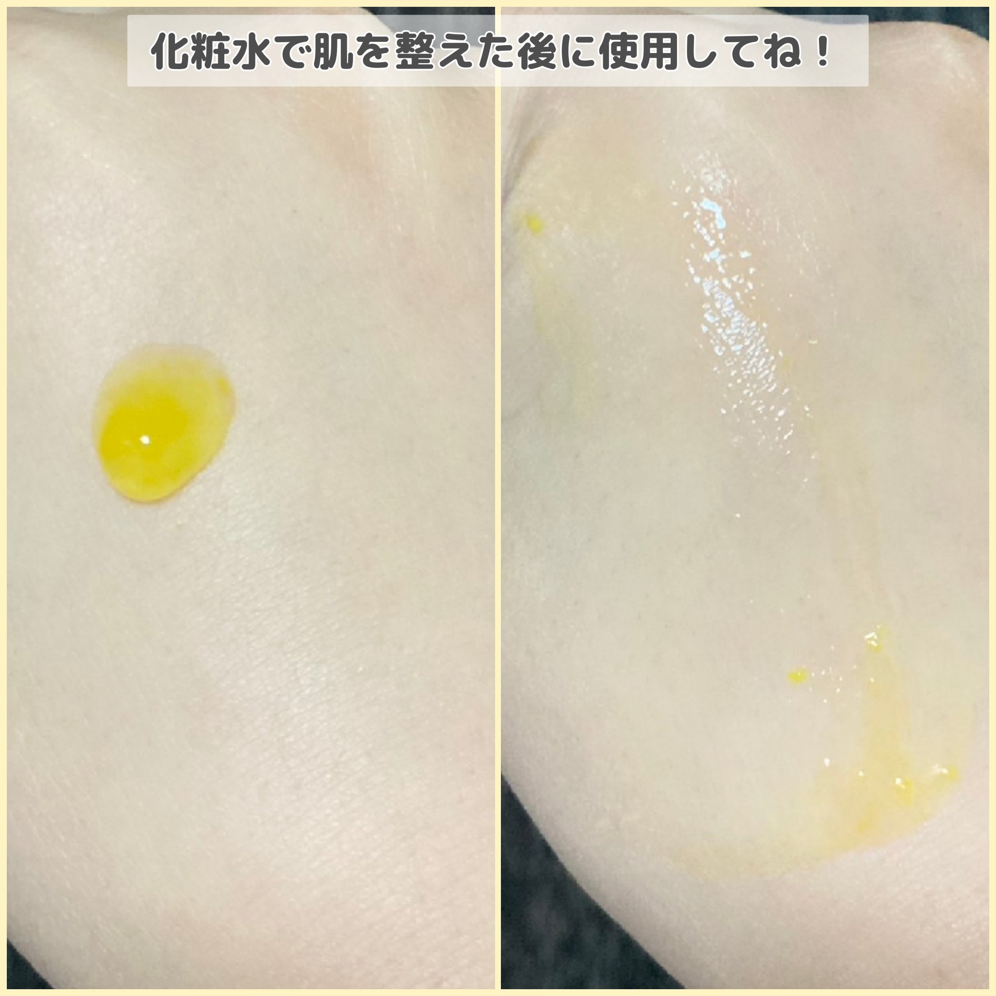 CPセラム V 美容液/カプセルセラム/美容液を使ったクチコミ（3枚目）