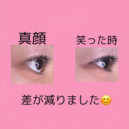 ポイントコンシーラー/CipiCipi/ペンシルコンシーラーを使ったクチコミ(8枚目)