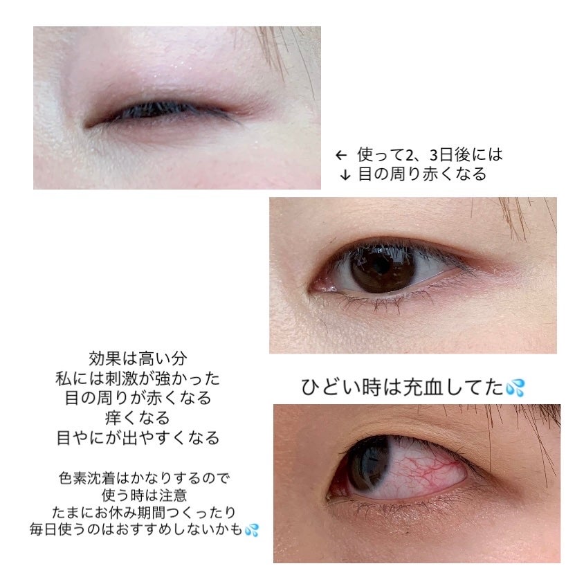 EMAKED(エマーキット)/水橋保寿堂製薬/まつげ美容液を使ったクチコミ(3枚目)