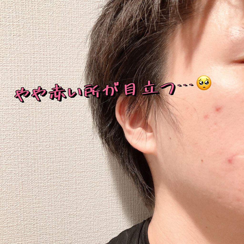 ドクダミ 77 スージングトナー/Anua/化粧水を使ったクチコミ（3枚目）