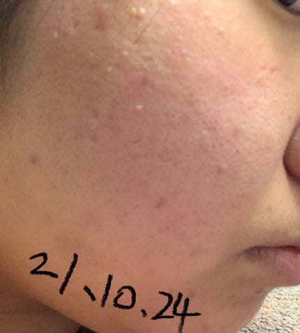 クリアウォッシュ/オルビス/洗顔フォームを使ったクチコミ(2枚目)