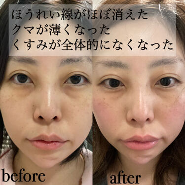 エイジングケア 薬用リンクルケアクリームマスク 無印良品の効果に関する口コミ エイジングケアにおすすめのフェイスクリーム ほうれい線 クマ 顔の By りな 敏感肌 30代前半 Lips