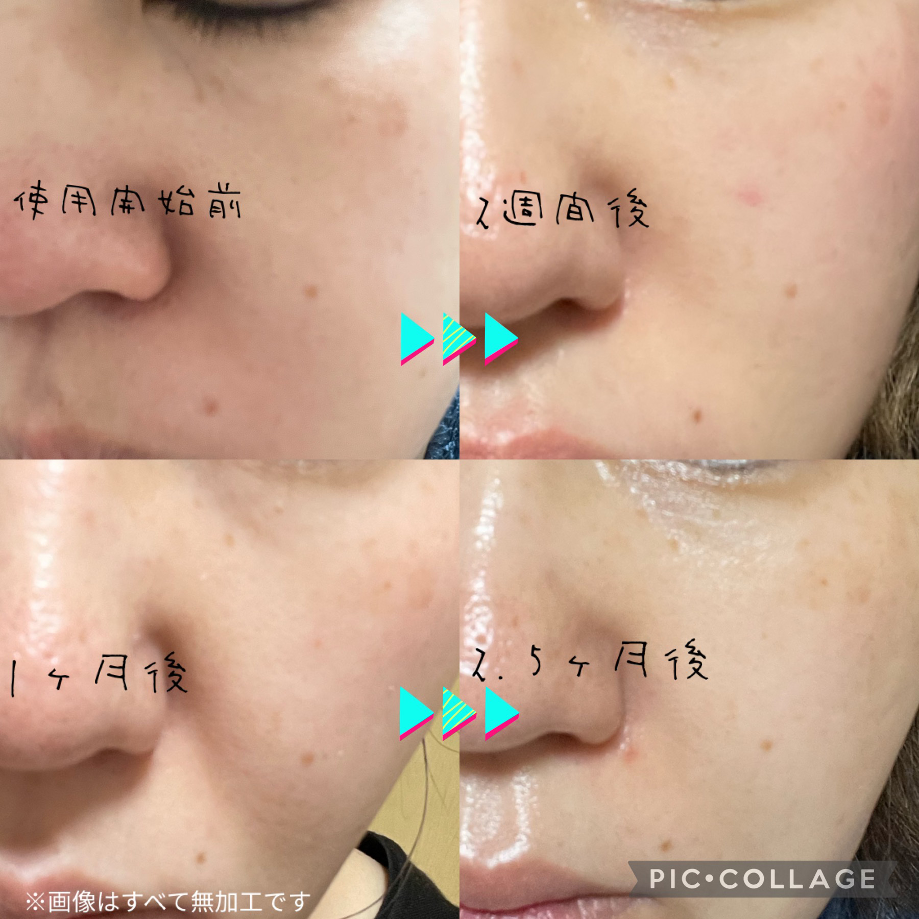 を使ったクチコミ（2枚目）