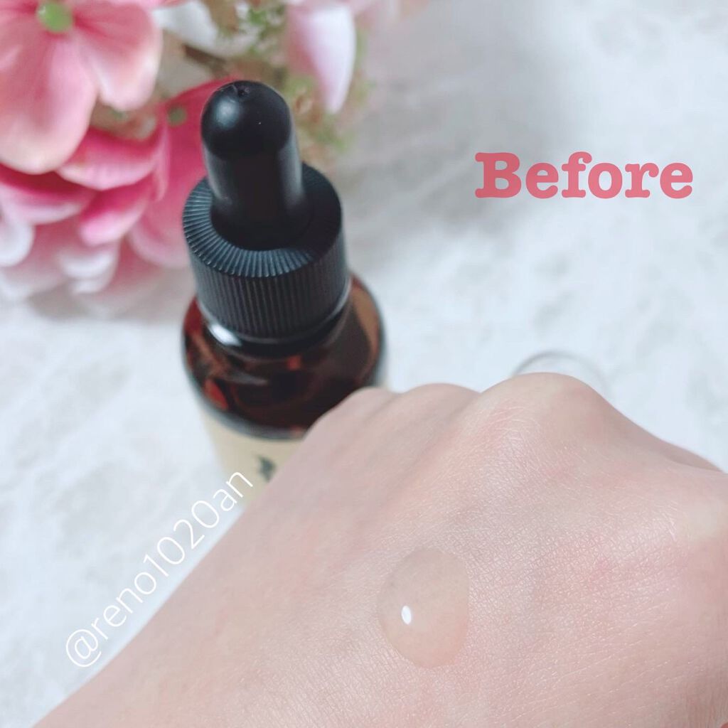 REプラセンタ美容液/RE(アール・イー)/美容液を使ったクチコミ(2枚目)