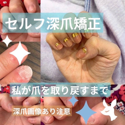 ジェルネイル/ジェルミーワン/ジェルネイルを使ったクチコミ(1枚目)