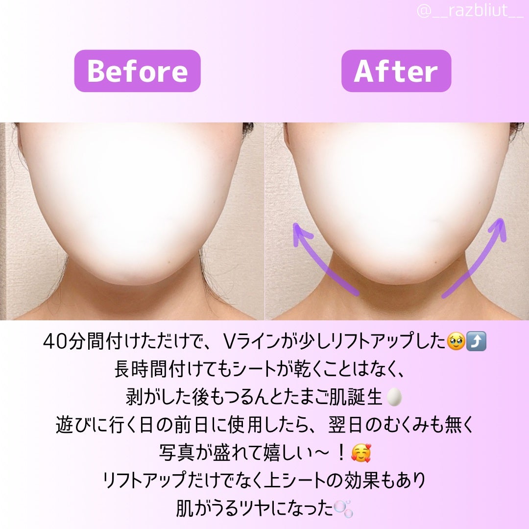 9番 NMNバイオリフトラッピングマスク/numbuzin/シートマスク・パックを使ったクチコミ(4枚目)