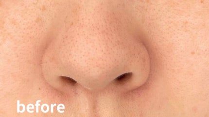 ビーエスコスメ エッセンスTWAのクチコミ「毛穴にはやっぱりレチノール?!
今年に入ってから毛穴ケアに力を入れて来ました💪🏻
酵素洗顔試.....」(1枚目)