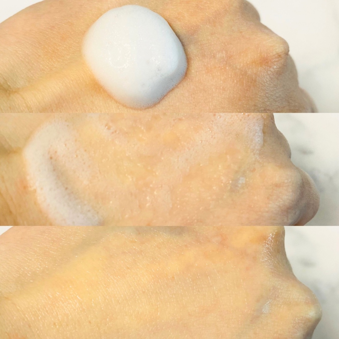 ペプチドボリュームマスタートナー/DR.PEPTI/ブースター・導入液を使ったクチコミ（3枚目）