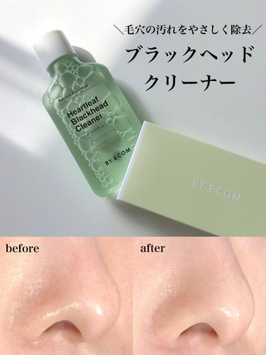 毛穴の黒ずみをやさしく除去する👃
ブラックヘッドクリーナー

🏷️ブランド名:BY ECOM -Heartleaf Blackhead Cleaner
 "詰まり毛穴"をケアするブラックヘッドクリーナー