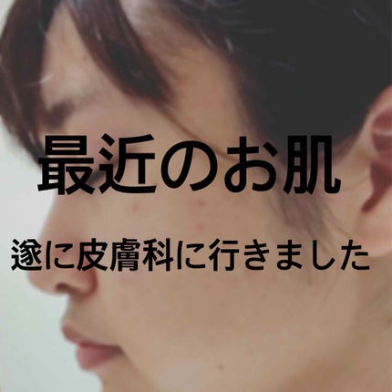 オードムーゲ 薬用ローション(ふきとり化粧水)/オードムーゲ/拭き取り化粧水を使ったクチコミ(1枚目)