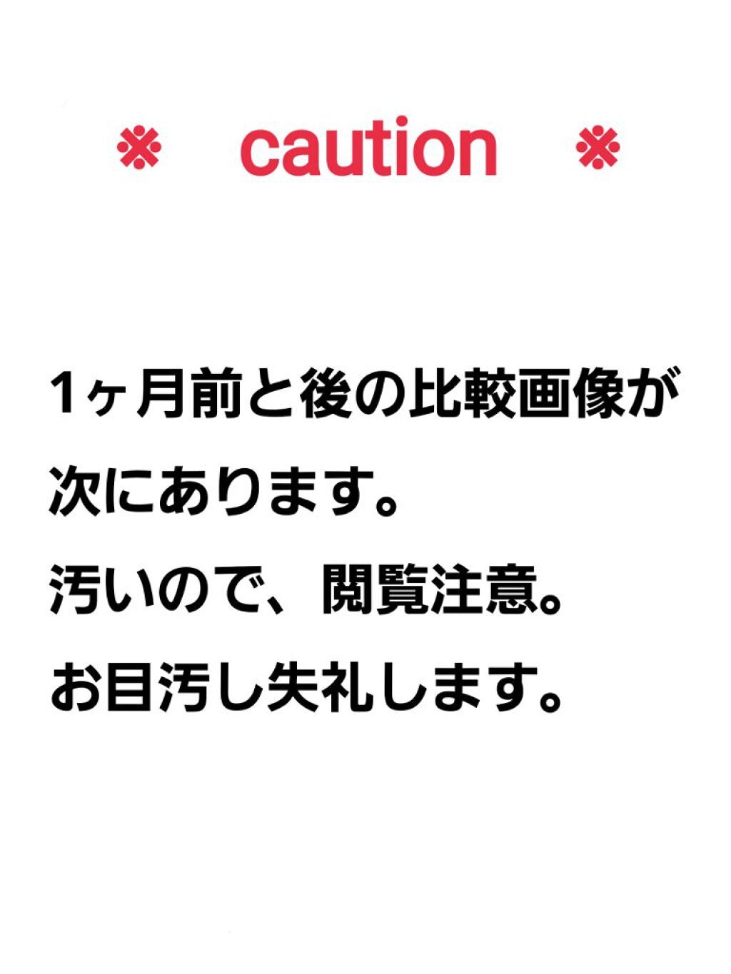 チョコラBBプラス (医薬品)/チョコラBB/その他を使ったクチコミ(2枚目)