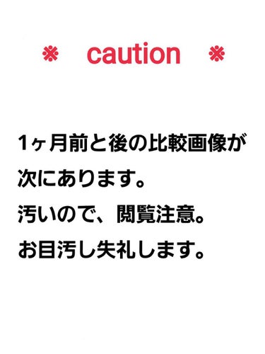 薬用 しみ 集中対策 美容液/メラノCC/美容液を使ったクチコミ（2枚目）