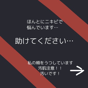 オルビス クリアウォッシュのクチコミ「ニキビ肌に悩んでいます、しずくです。



ほんとに汚いので見る方は注意してください！！

も.....」（1枚目）