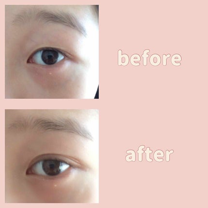 【旧品】オリシキ アイリッドスキンフィルム/D-UP/二重まぶた用アイテムを使ったクチコミ(4枚目)