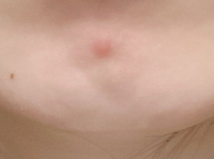 ハトムギ化粧水(ナチュリエ スキンコンディショナー R )/ナチュリエ/化粧水を使ったクチコミ(2枚目)