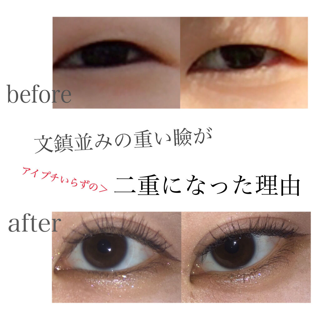 ワンダーアイリッドテープ Extra/D-UP/二重まぶた用アイテムを使ったクチコミ（1枚目）