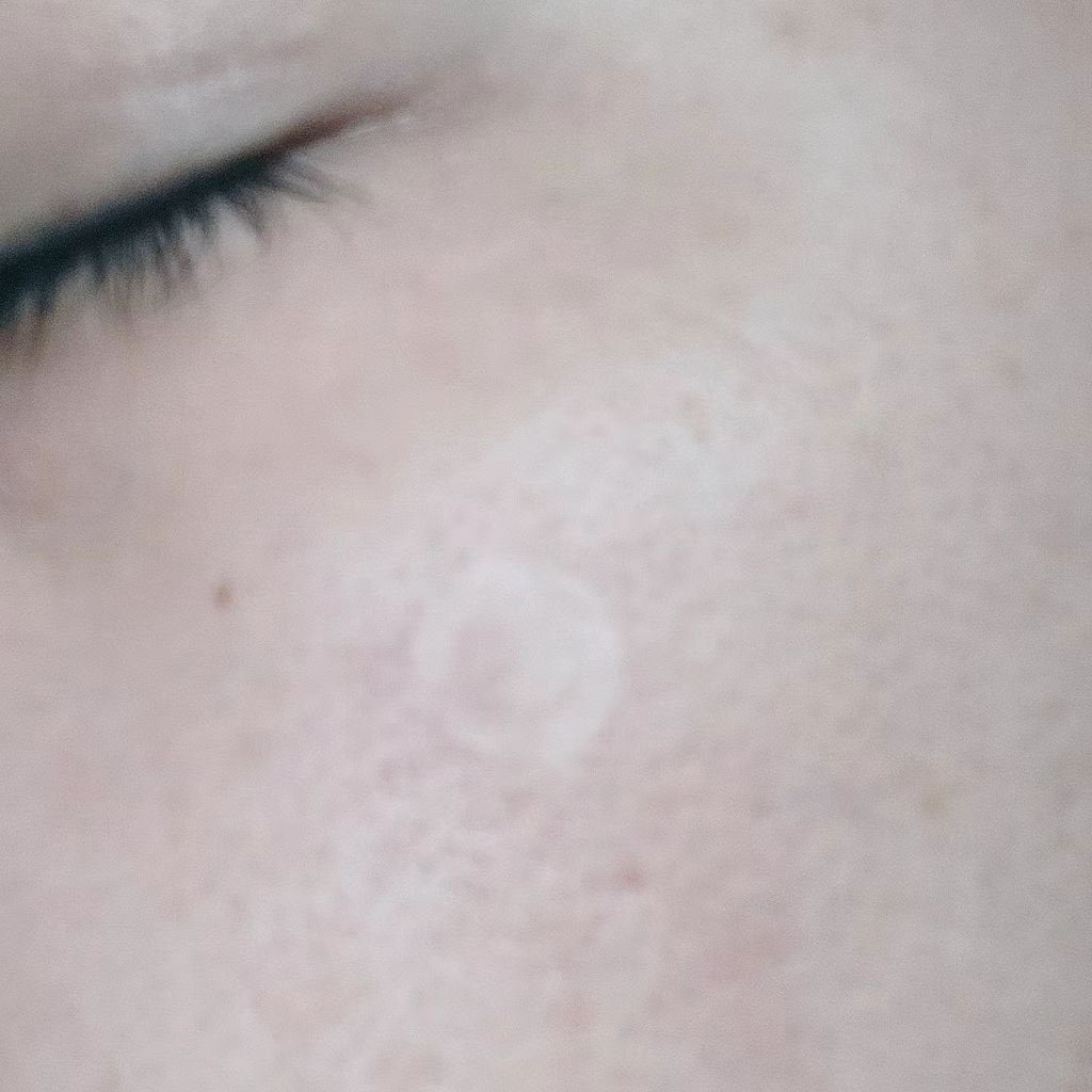 エイクリアスポットキュアパッチ/Dr.G/その他スキンケアを使ったクチコミ(4枚目)