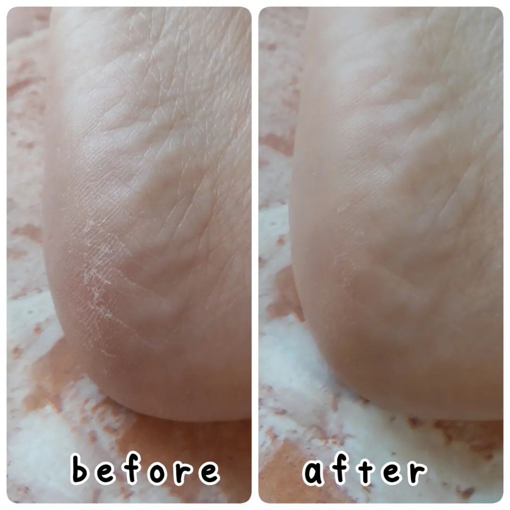 ボディスクラブ ブラッシャー クリア/アーレス/ボディスクラブを使ったクチコミ（3枚目）