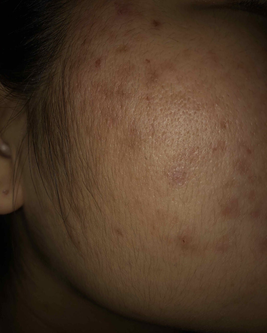 ハトムギ化粧水(ナチュリエ スキンコンディショナー R )/ナチュリエ/化粧水を使ったクチコミ(4枚目)