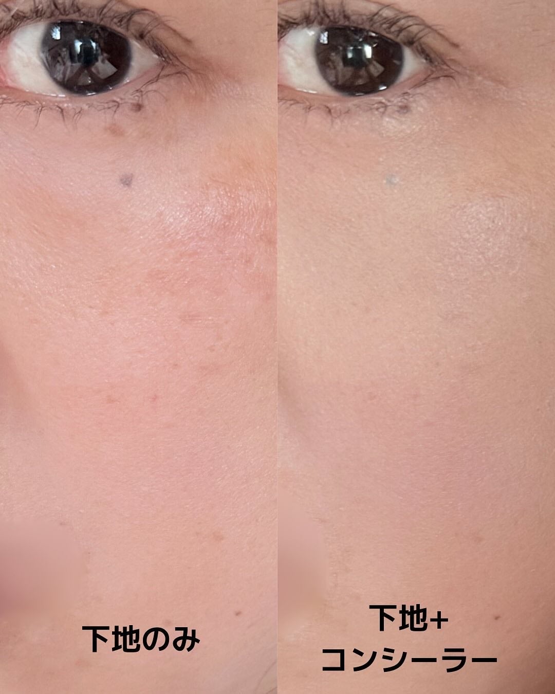 ブリージングコンシーラーパレット/Healus/パレットコンシーラーを使ったクチコミ(5枚目)