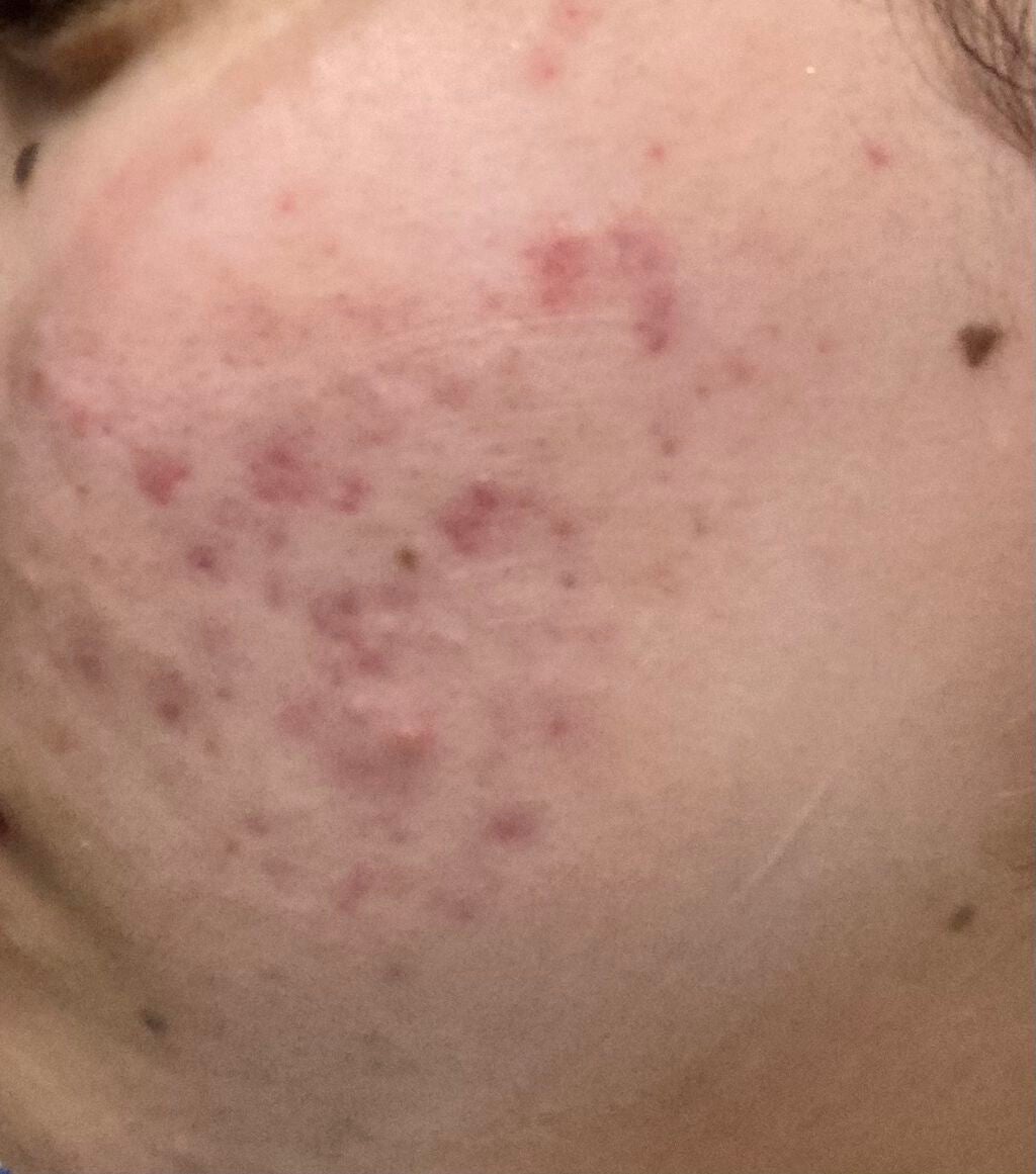 保湿クリーム /ちふれ/フェイスクリームを使ったクチコミ(1枚目)