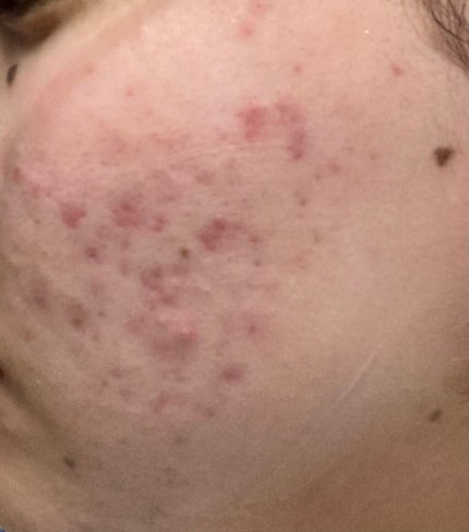 保湿クリーム /ちふれ/フェイスクリームを使ったクチコミ(1枚目)