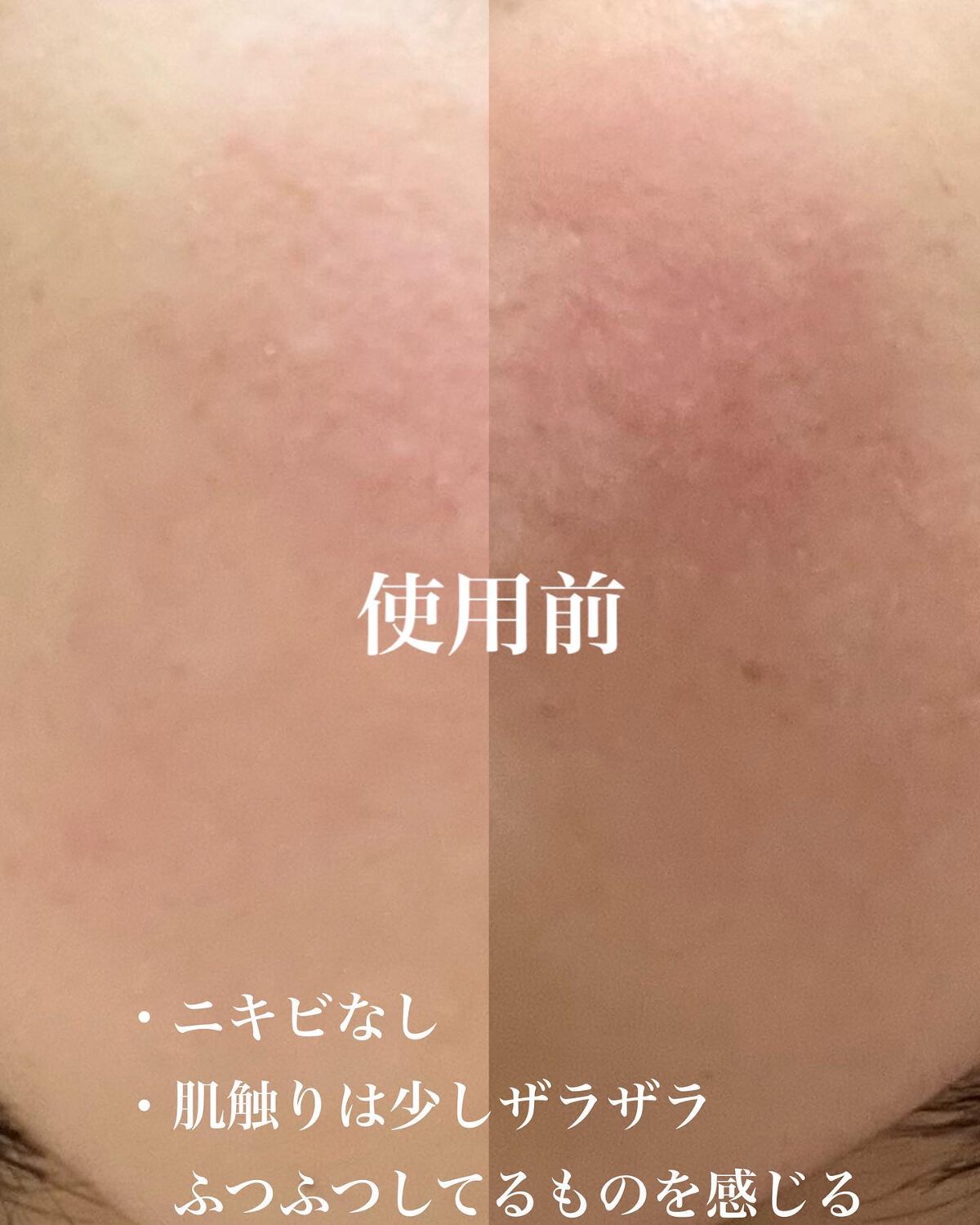 レチノールインテンシブ アドバンスドトリプルアクションアイクリーム/SOME BY MI/アイケア・アイクリームを使ったクチコミ（2枚目）