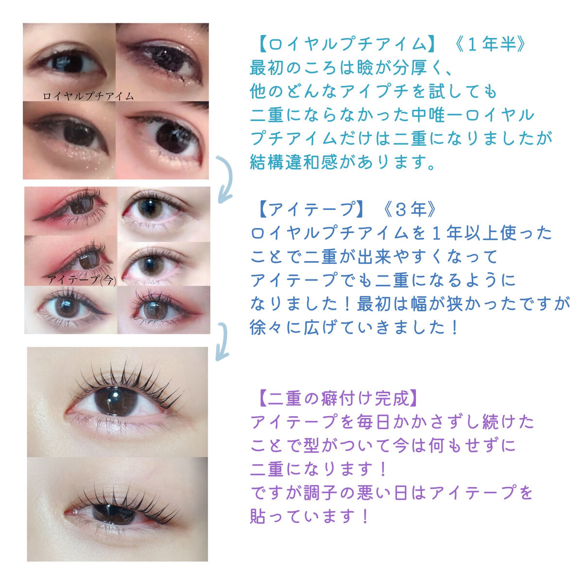 50セット‼️ダイソー のびーるアイテープ 二重テープ 絆創膏タイプ