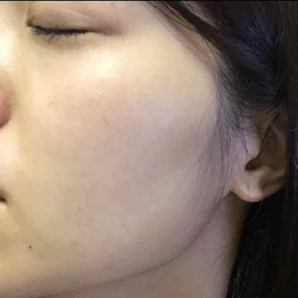 エリクシール ホワイト クリアローション C II/エリクシール/化粧水を使ったクチコミ（2枚目）