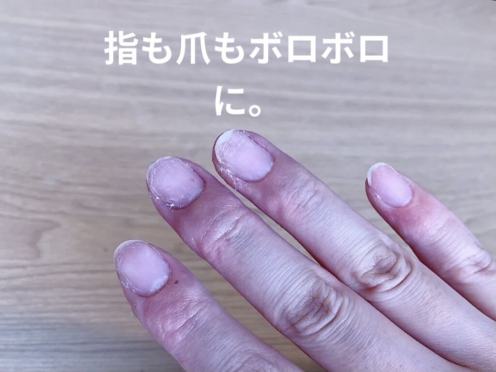 ジェルネイル/セリア/ジェルネイルを使ったクチコミ（3枚目）