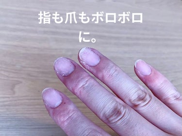 Gel Nail/セリア/マニキュアを使ったクチコミ（3枚目）