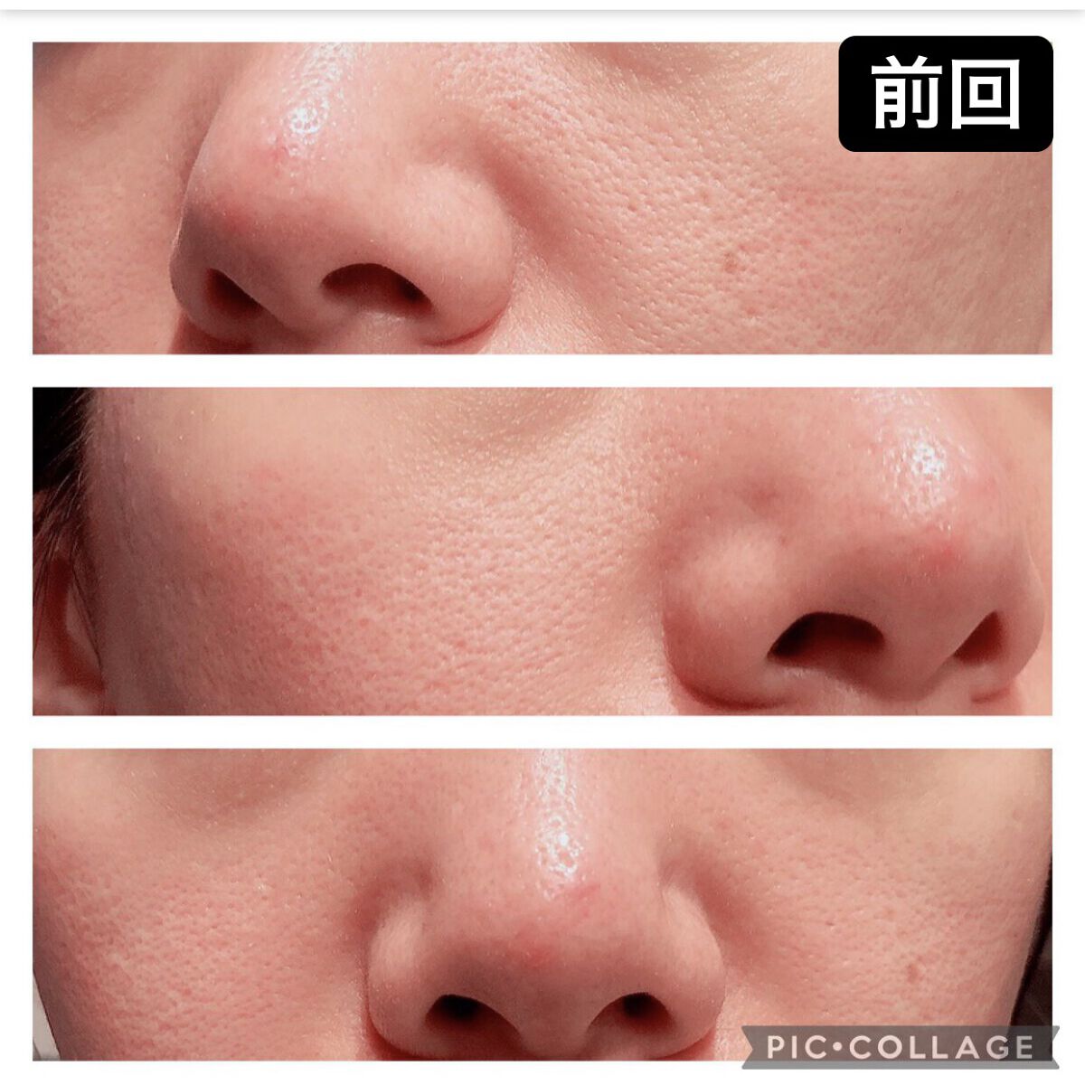 5種のセラミド配合化粧水/Aoyama・Labo/化粧水を使ったクチコミ（3枚目）