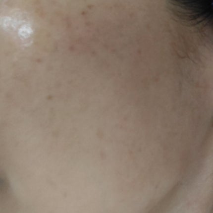 アスタリフト ホワイト ジェリー アクアリスタ/アスタリフト/美容液を使ったクチコミ(7枚目)