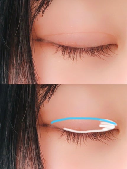 アイビューティー フィクサー WP/アストレア ヴィルゴ/二重まぶた用アイテムを使ったクチコミ(2枚目)