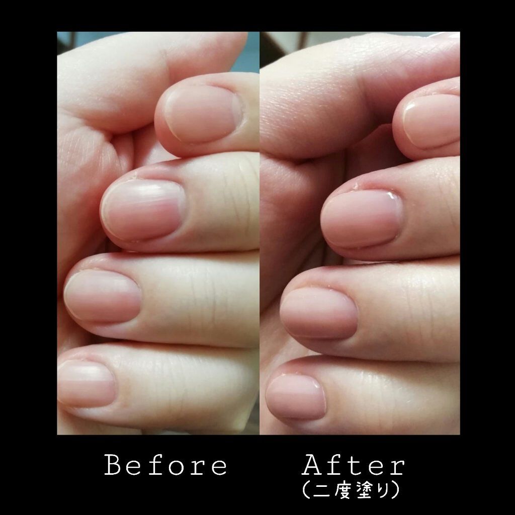ディーアップファンデーション/D-UP/ネイルベースコートを使ったクチコミ（2枚目）