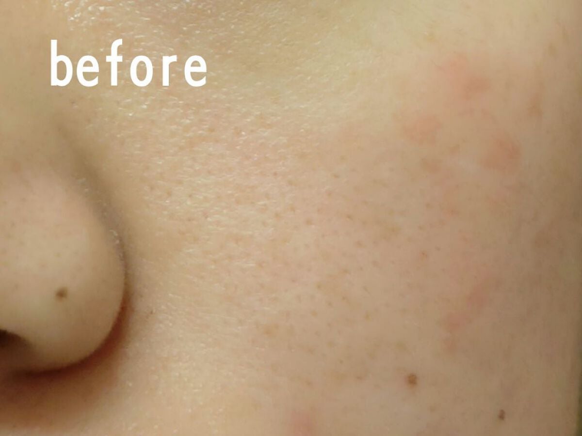 W.H.P ブラックマスク JEX/MEDIHEAL/シートマスク・パックを使ったクチコミ(4枚目)