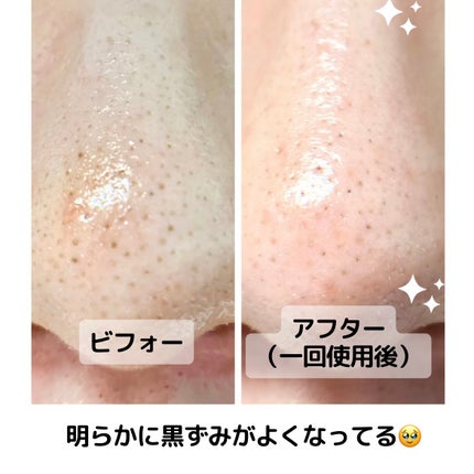 ティーツリーハーブピーリングパック/WellDerma/洗い流すパック・マスクを使ったクチコミ(3枚目)