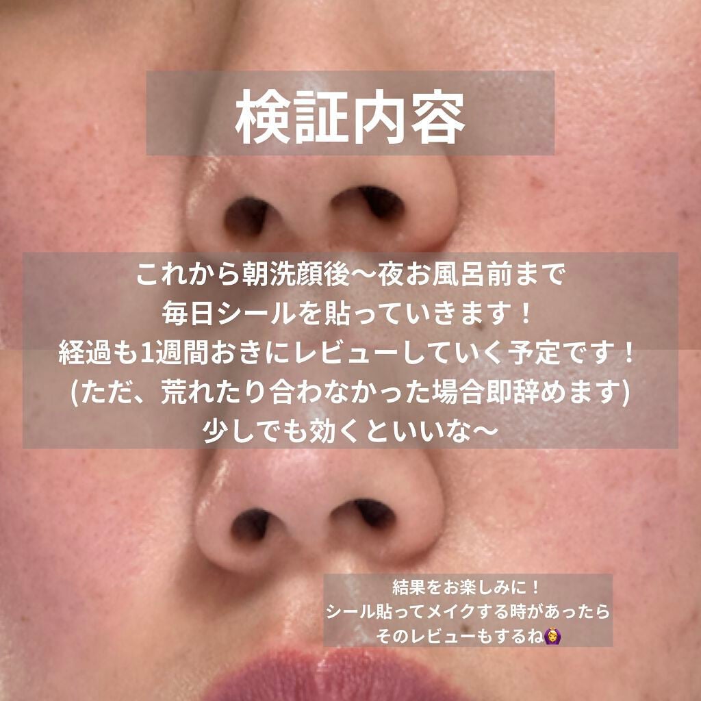 ハイドロコロイドスキンパッチ/ビューティーワールド/その他を使ったクチコミ(6枚目)