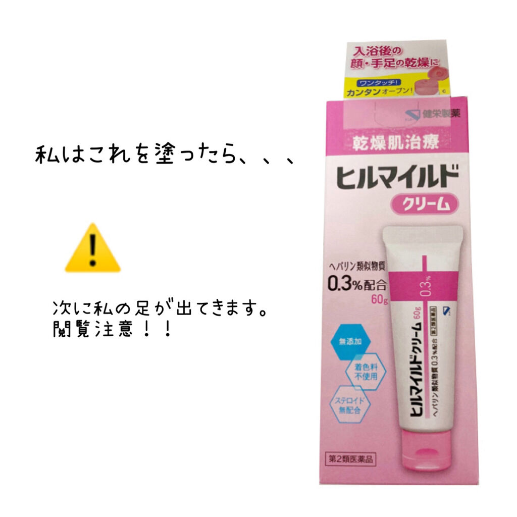 ヒルマイルドクリーム(医薬品)/健栄製薬/その他を使ったクチコミ（2枚目）