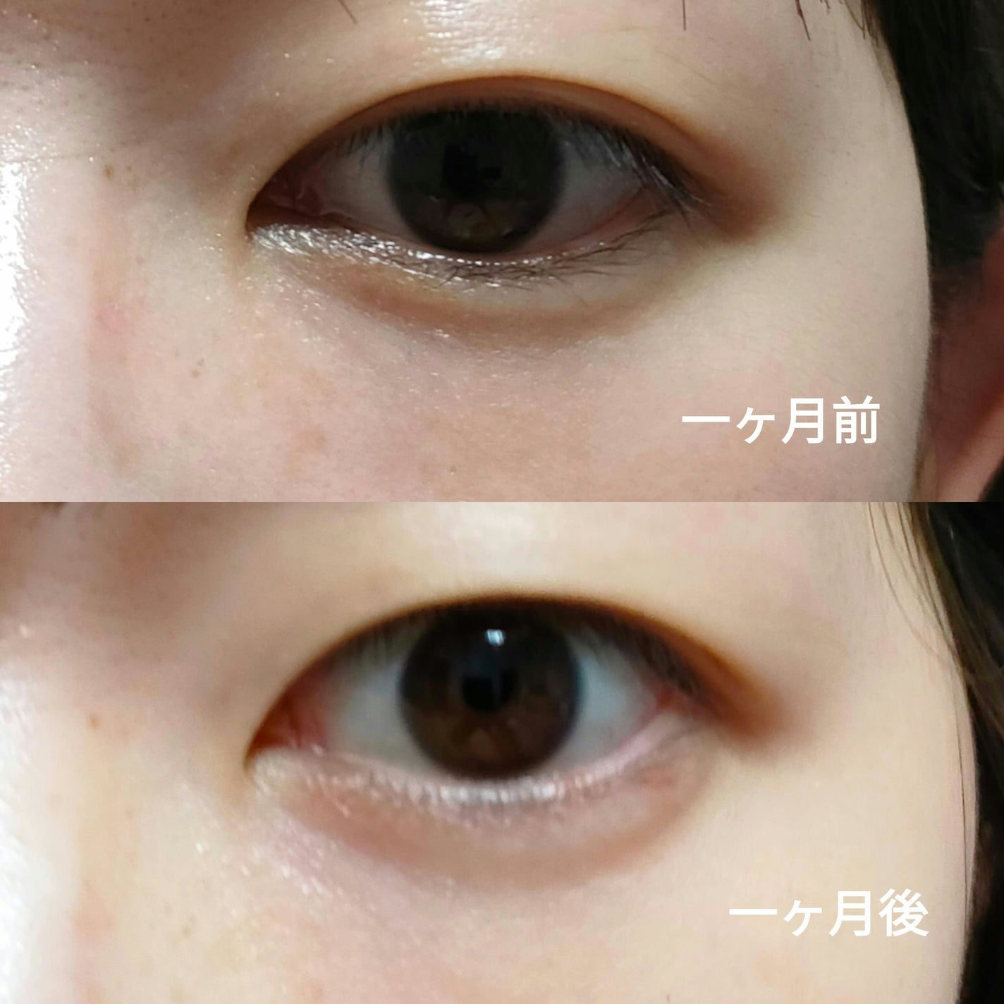 リプダム オートアイクリーム/Dr.Twenty Project/アイケア・アイクリームを使ったクチコミ(3枚目)