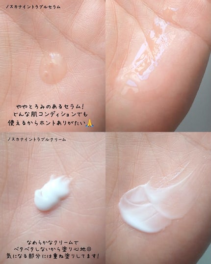 ノスカナイン トラブル セラム/FATION/美容液を使ったクチコミ(4枚目)