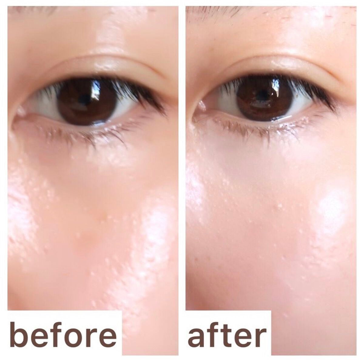 【旧】ディオールスキン フォーエヴァー スキン コレクト コンシーラー/Dior/リキッドコンシーラーを使ったクチコミ(5枚目)